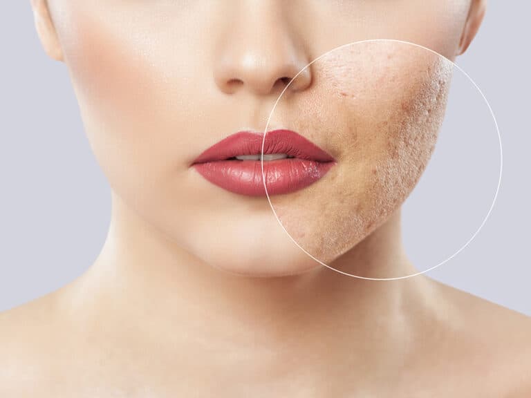 Anti Aging